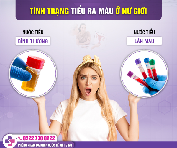 [CẢNH BÁO] Hơn 95% tình trạng tiểu ra máu ở nữ là do bệnh lý