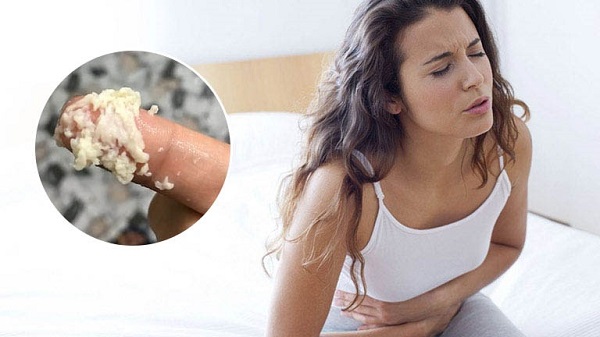 Nấm trắng bã đậu vùng kín: Nguyên nhân, triệu chứng và cách khắc phục